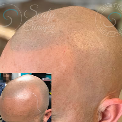 SMP Before & After